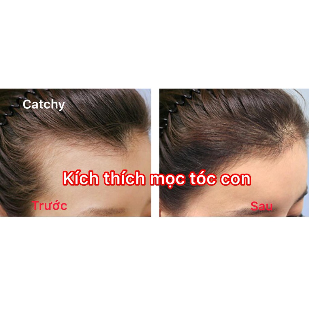 Dầu gội xả BƯỞI CatChy 2in1 thúc đẩy quá trình mọc tóc và chống rụng tóc  | BigBuy360 - bigbuy360.vn