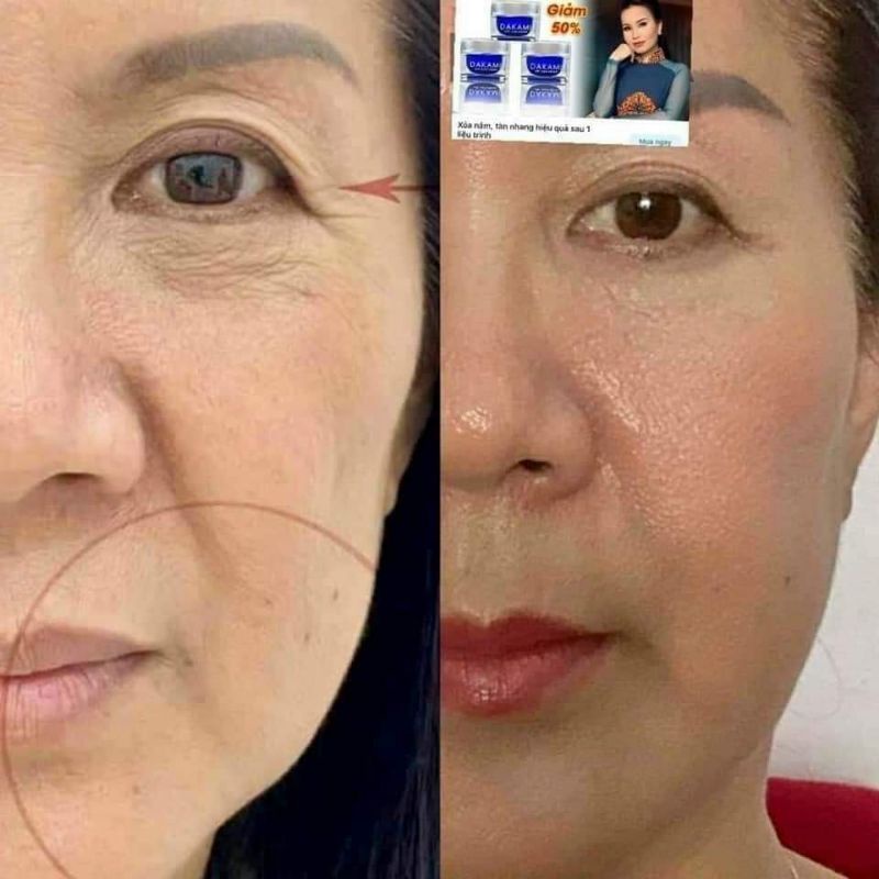 Kem Ngày Dakami K-White Chính Hãng Mua 2 Tặng 1
