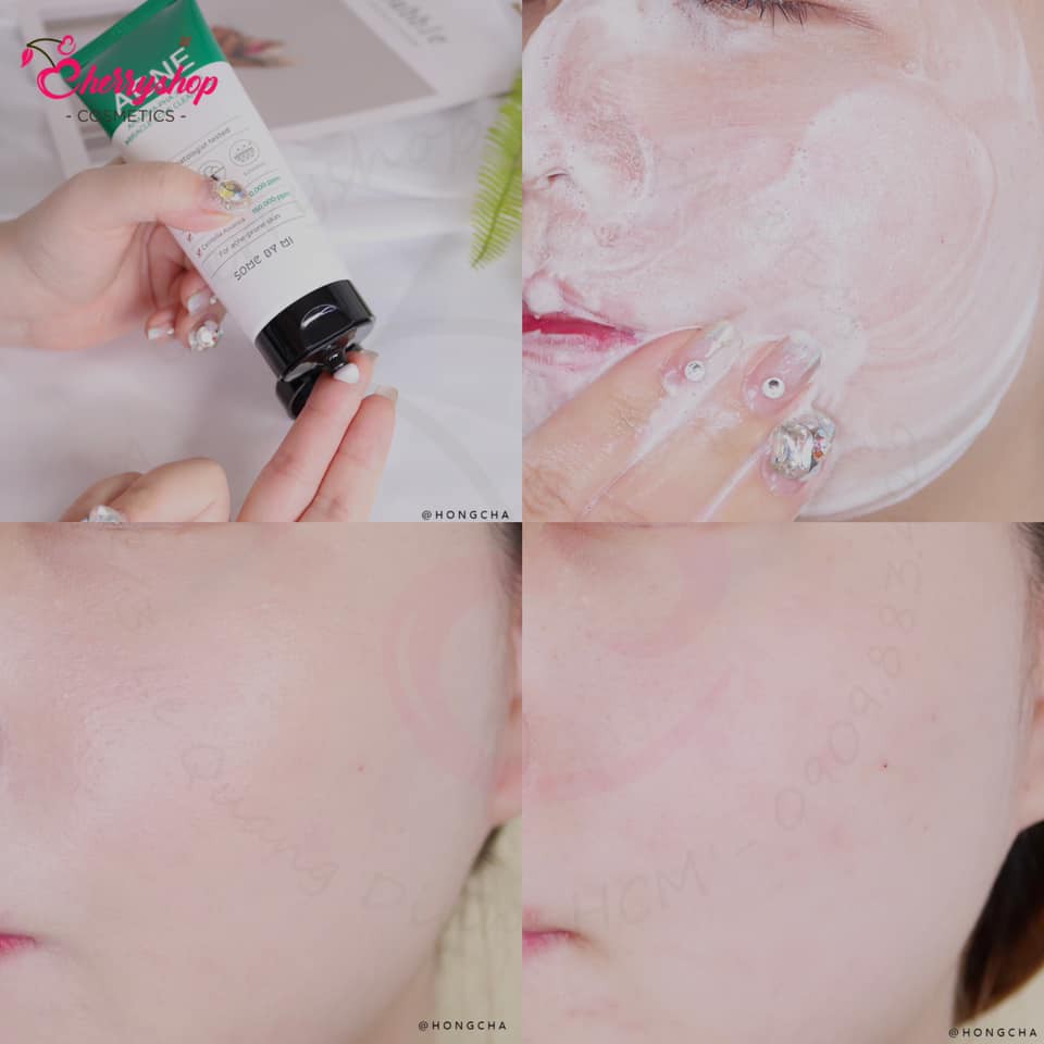 💥🍒Sữa Rửa Mặt Some By Mi AHA-BHA-PHA 30 Days Miracel Acne Clear Foam