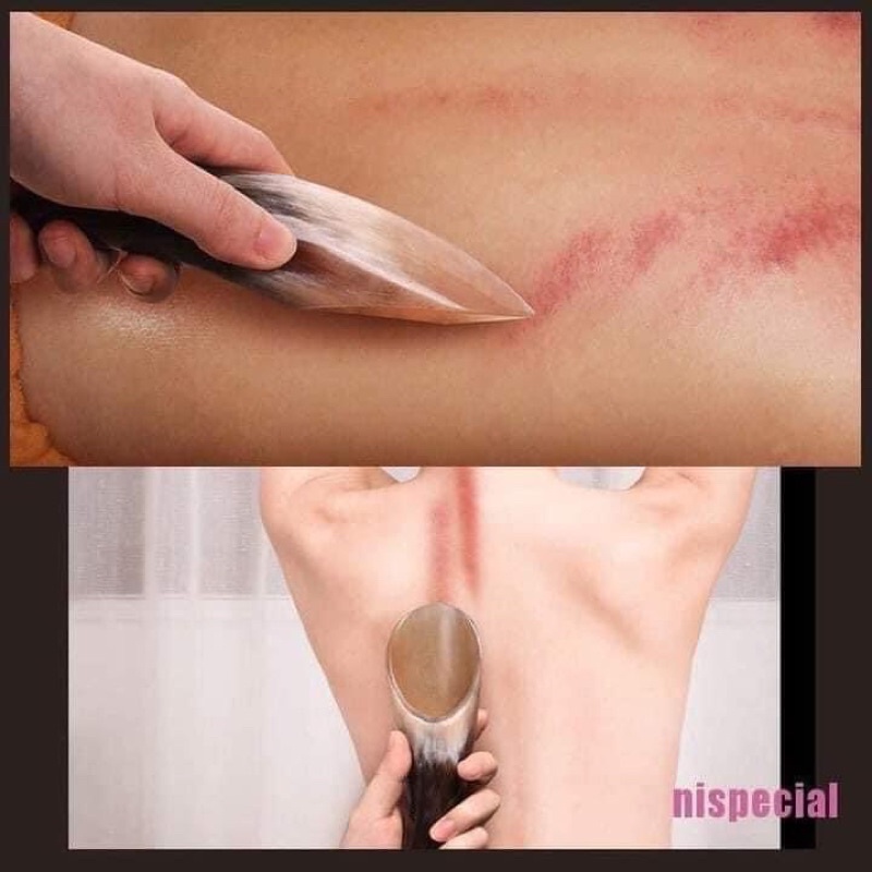 Dụng cụ cạo gió và day ấn huyệt bằng sừng