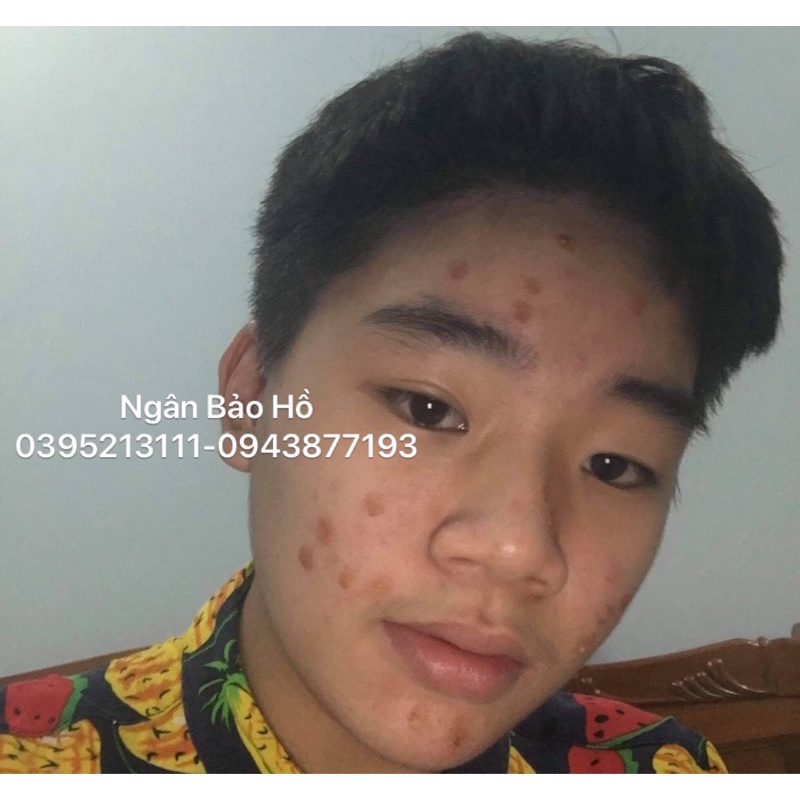 Tái tạo da cốt mạnh đông y gia truyền tặng bột rửa mặt ngừa mụn thâm nám hiệu quả