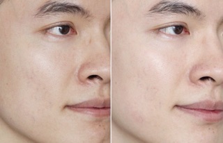Serum dưỡng ẩm và phục hồi da Timeless B5 Hydration