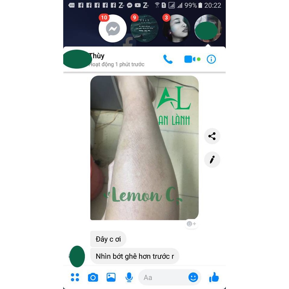 Combo viêm nang lông, mụn lưng (mỡ trăn + 3 gói bôt tắm Lemon C) | BigBuy360 - bigbuy360.vn