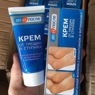 (nội địa Nga) Kem trị nứt gót chân Kpem Nga 50ml