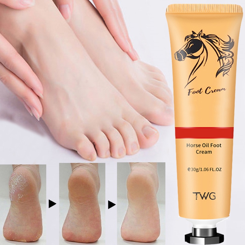 Kem Dưỡng Ẩm Da Chân Chống Nứt Nẻ Dành Cho Đi Du Lịch Ngoài Trời