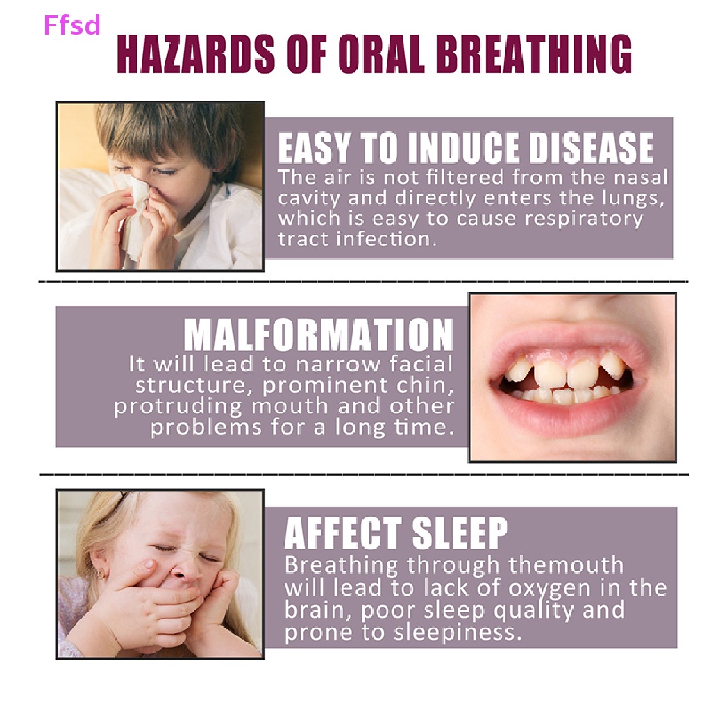 Set 30 Miếng Dán Chống Ngáy Tiện Dụng Khi Ngủ