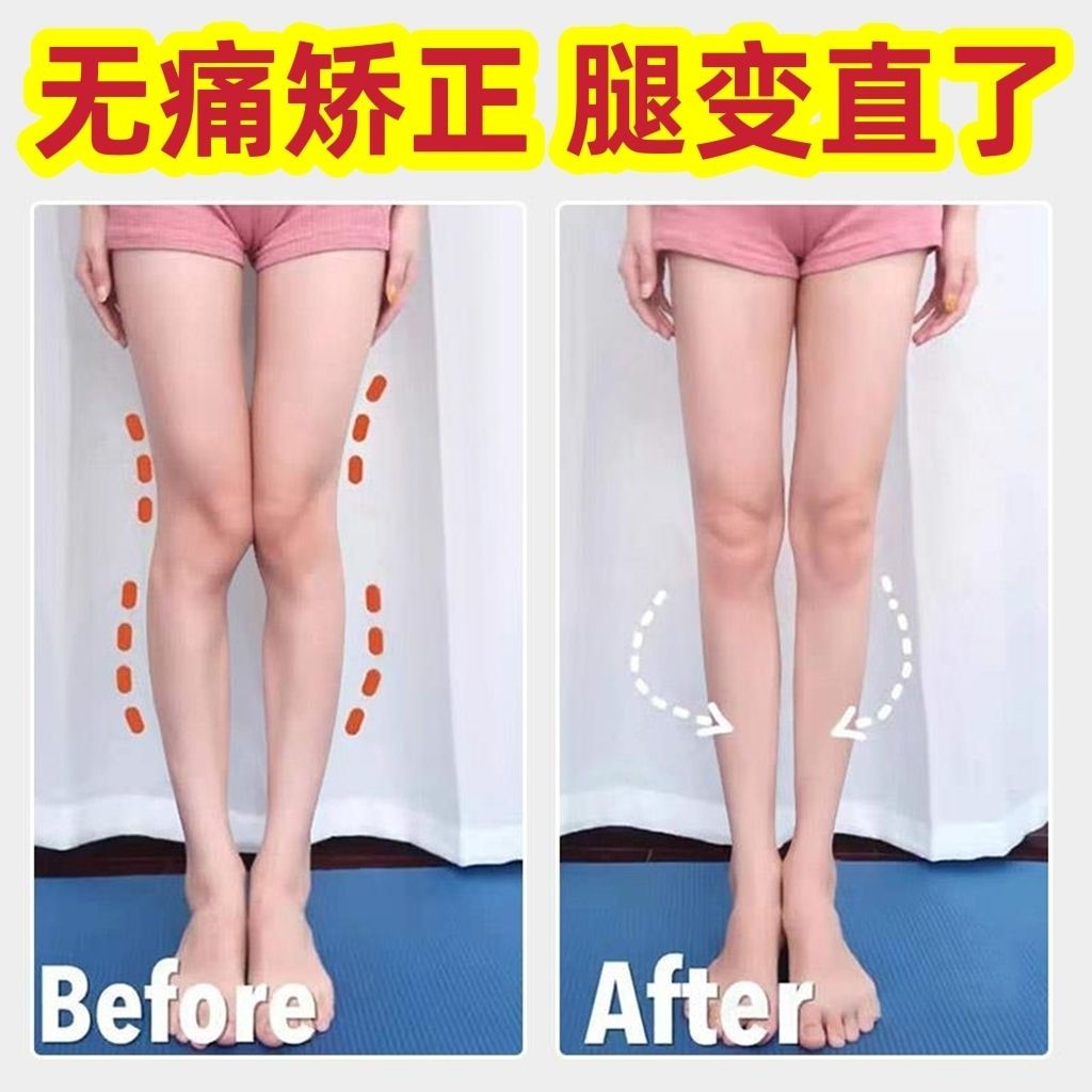 Hàng Có Sẵn Giao Hàng Ngay Lập Phương#Đế Lót Giày Hình Chữ o Loại x Chỉnh Tư Thế Bàn Chân Cho Người Lớn Và Trẻ Em 7 / 27yy