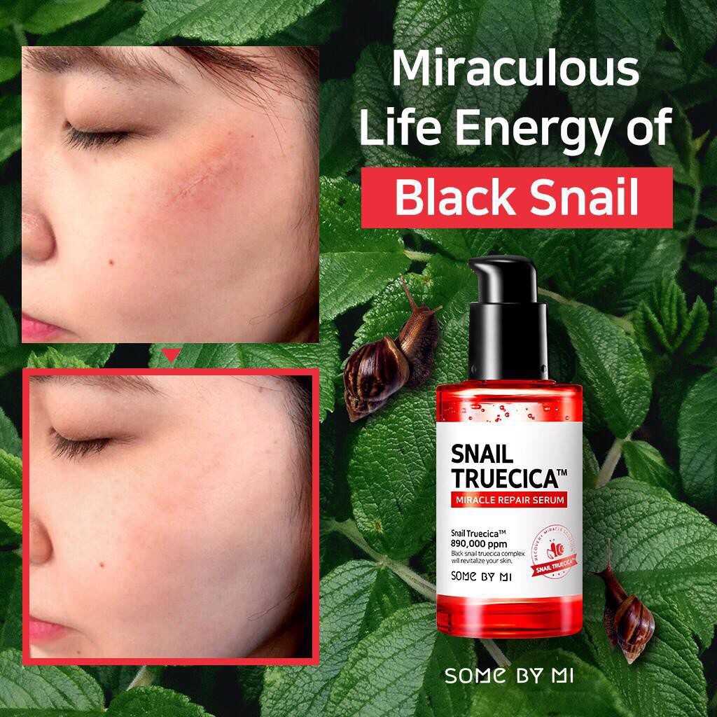 Tinh Chất Ốc Sên Mờ Sẹo, Phục Hồi Da Some By Mi Snail Truecica Serum 50ml | BigBuy360 - bigbuy360.vn
