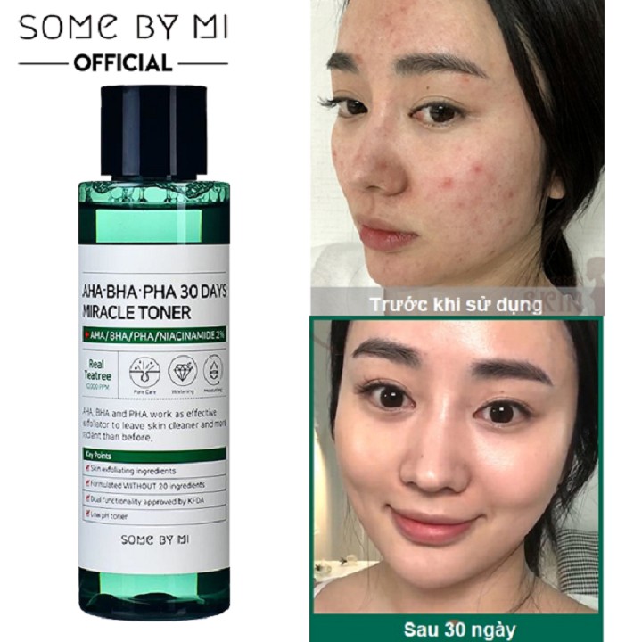 Nước hoa hồng Some By Mi AHA-BHA-PHA 30 Days Miracle Toner 150ml dành cho da mụn