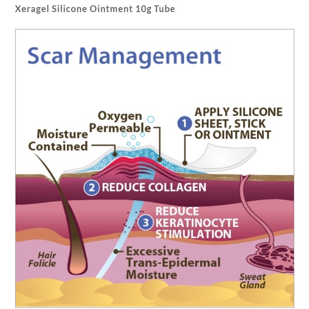 Gel giảm sẹo xeragel chính hãng biodermis 100% silicone