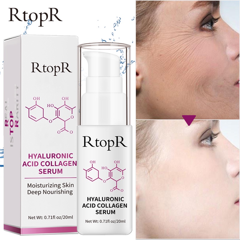 Tinh Chất Dưỡng RtopR Từ Hyaluronic Acid Collagen Hỗ Trợ Giảm Mụn Chống Nếp Nhăn Làm Trắng Da 20ml