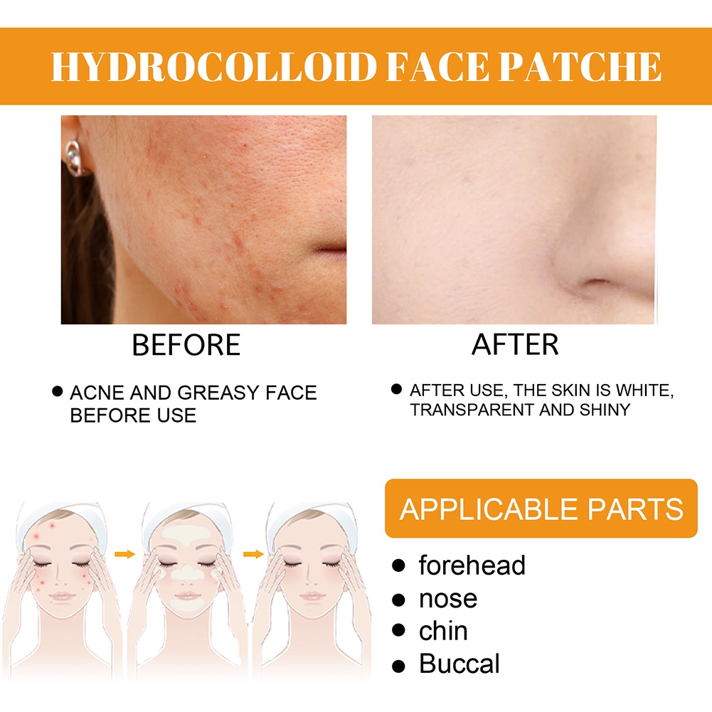 EELHOE Mụn Vá Hydrogel Mặt Mụn Mụn Vá Hydrocolloid Gel Da TAG Điều Trị Loại Bỏ Dán Chăm Sóc Da Mặt Cầm Tay Trong Suốt Vô Hình vá Nhanh giao hàng