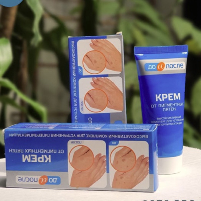 Kem xoá đồi mồi Nga - Kem đồi mồi