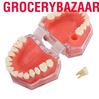 Grocerybazaar Gingiva Model Removable Teeth Soft Oral Demonstrating Dental Practice Teaching Tool