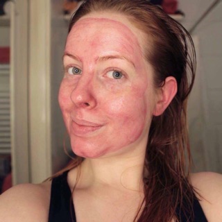 Peel da hoá học The Ordinary AHA 30% + BHA 2% peeling solution