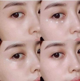𝐊𝐞𝐦 𝐦ắ𝐭 𝐀𝐇𝐂 𝐑𝐞𝐚𝐥 𝐄𝐲𝐞 𝐂𝐫𝐞𝐚𝐦 𝐅𝐨𝐫 𝐅𝐚𝐜𝐞 𝐋𝐢𝐦𝐢𝐭𝐞𝐝 phiên bản giới hạn