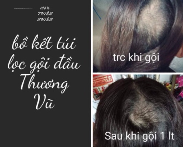 [Siêu Sale] 1 bịch 20 gói túi lọc bồ kết Thương Vũ