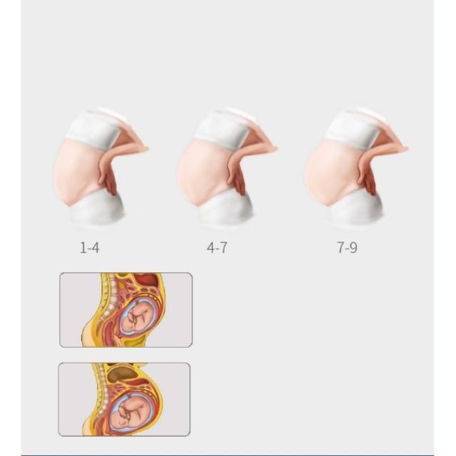 Đai nâng đỡ bảo vệ bụng bầu chống đau lưng  -  BRN