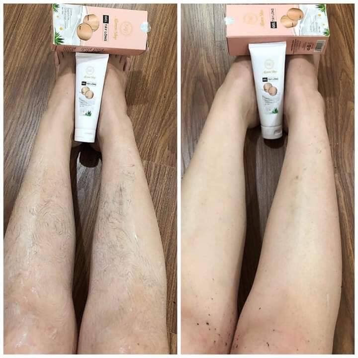 Kem TRIỆT LÔNG MAMEN CHÍNH HÃNG- Triệt lông tay, lông chân, lông vùng kín- Triệt lông vĩnh viễn- Cam kết chính hãng ———- | BigBuy360 - bigbuy360.vn