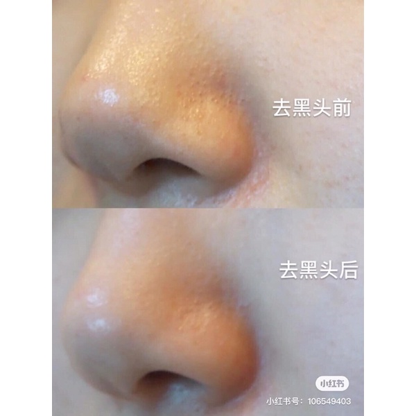 Sáp dưỡng Vaseline 100ml