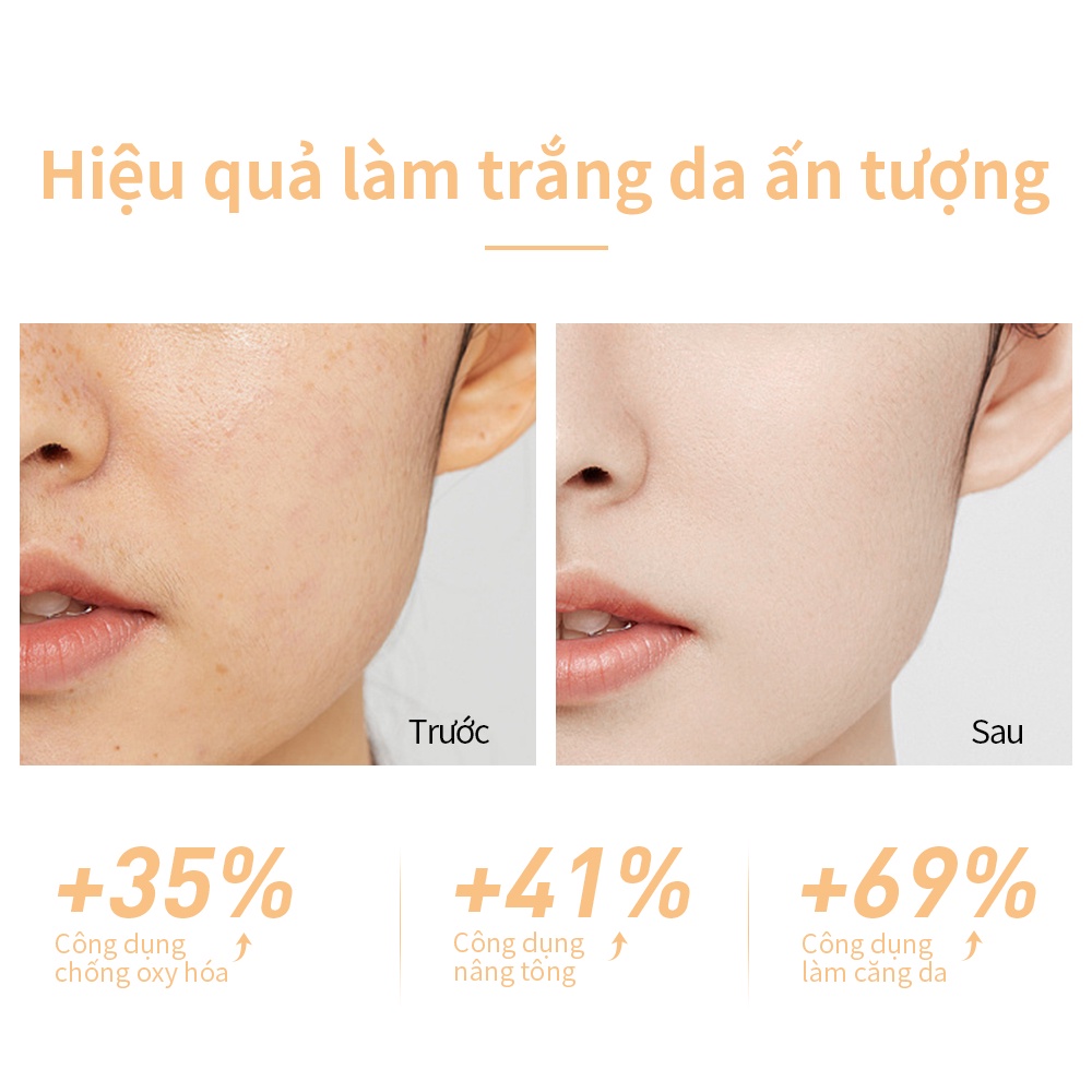 Tinh Chất Niacinamide kem dưỡng da mặt LANBENA Dưỡng Ẩm Làm Trắng Và Làm Mờ Vết Thâm Trên Da 30ml