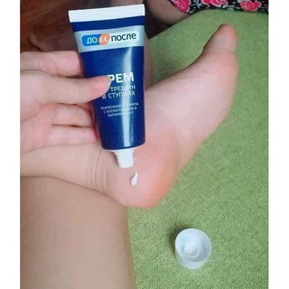 Kem trị nứt gót chân KPEM
