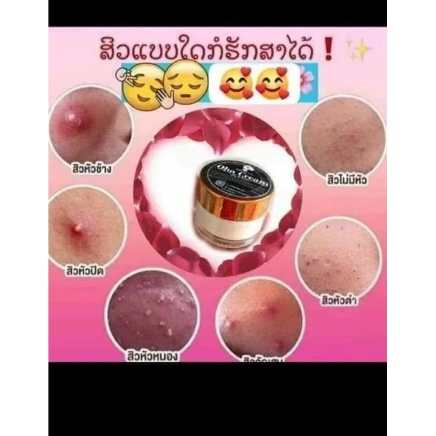 🖤Kem Oho cream ✨kem giảm mụn dưỡng mặt trắng☺