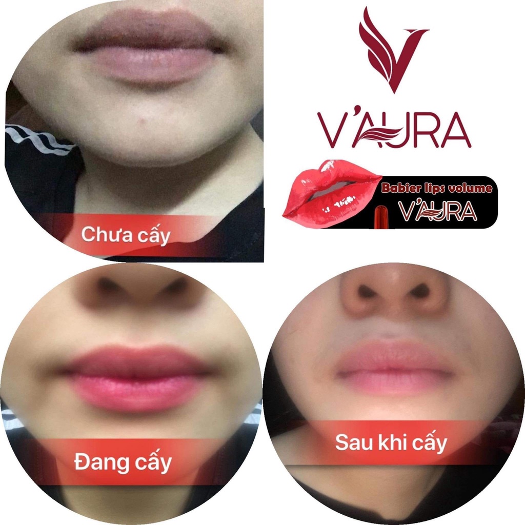 Bộ Tinh Chất Cấy Màu Môi Vaura Babier Lips Volume - Khử Thâm Môi - Giúp Môi Hồng Tự Nhiên - Mẫu Mới Nhất Claura Beauty