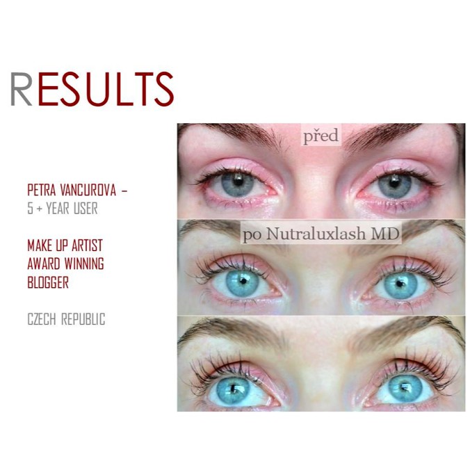 [Thuốc] Serum mọc mi Nutraluxe Lash MD USA - mọc mi trong vòng 14 ngày