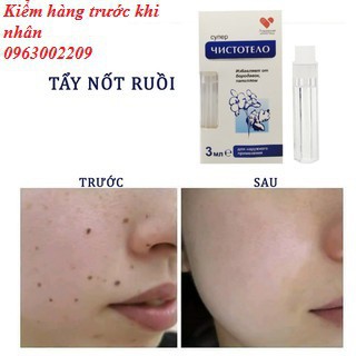 Thuốc chấm Mụn thị, Nốt ruồi, Mụn cóc, Mụn cơm Của Nga
