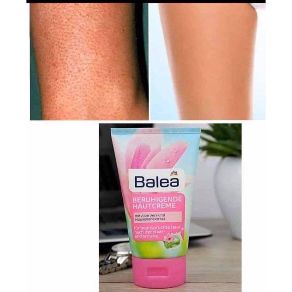 Kem dưỡng sau tẩy lông wax ức chế lông mọc Balea 125ml