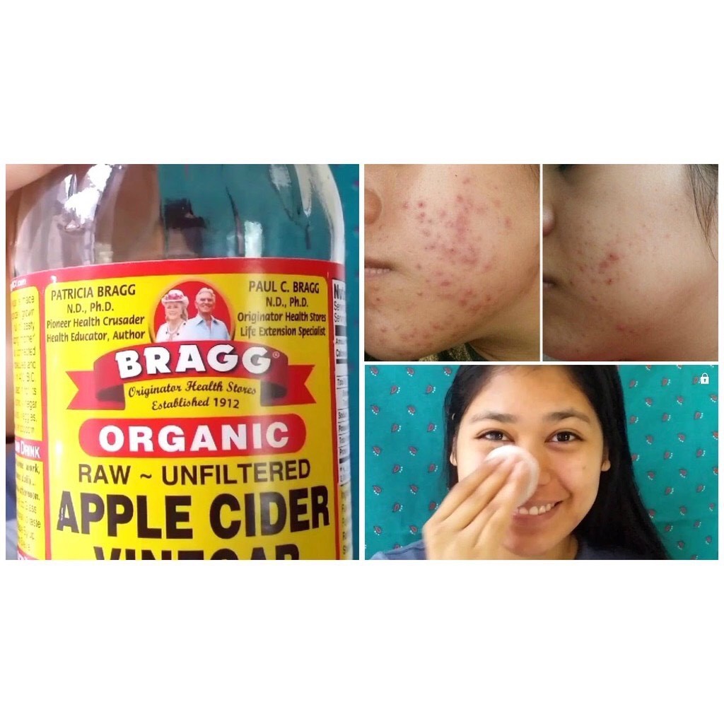 [MÃ FRIGBH111- 10% đơn 500K] Dấm táo Nhập khẩu Mỹ Organic Bragg có con dấm mẹ 473ml (Date 11.5.2023) | BigBuy360 - bigbuy360.vn