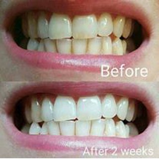 Kem đánh rắng trắng sáng AP24