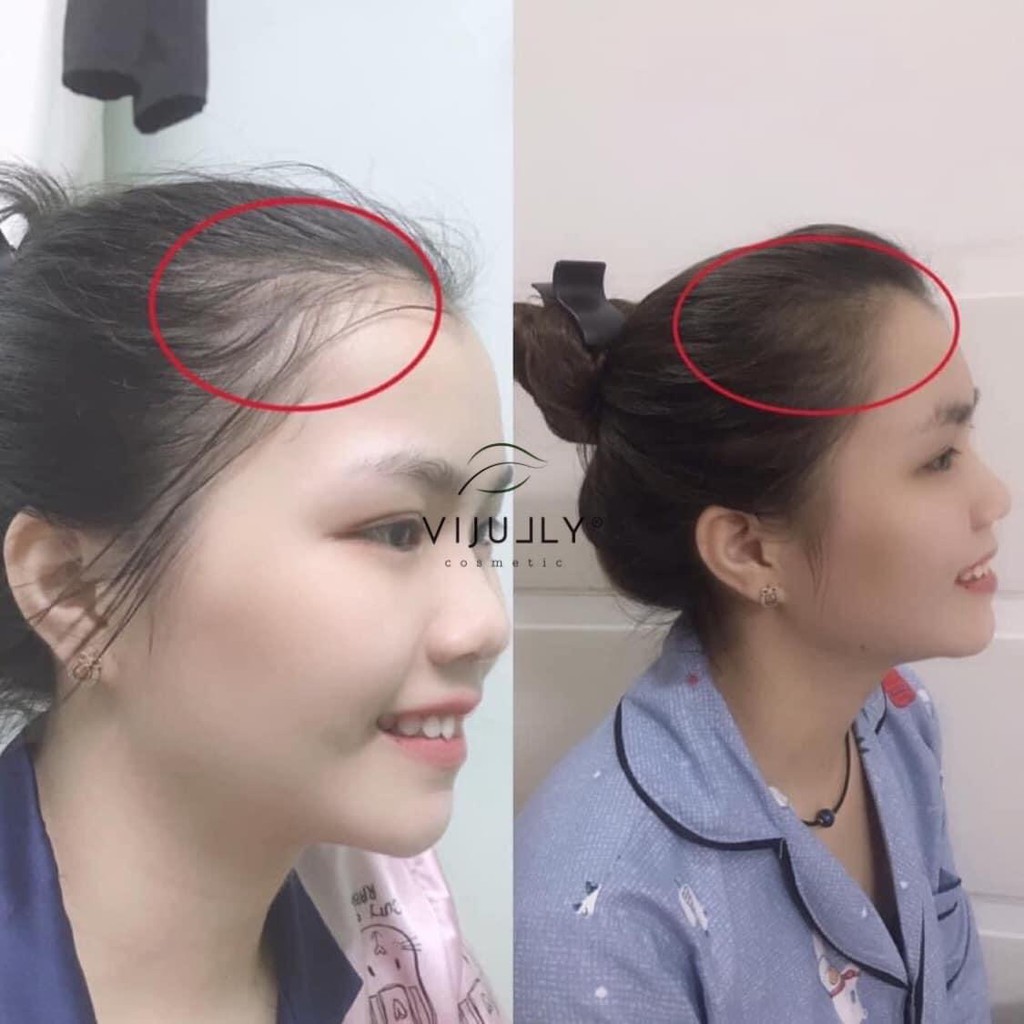 Tinh dầu bưởi VI JULLY dầu dưỡng tóc chính hãng, kích thích mọc tóc dày và dài, ngăn ngừa rụng tóc 100ml | BigBuy360 - bigbuy360.vn