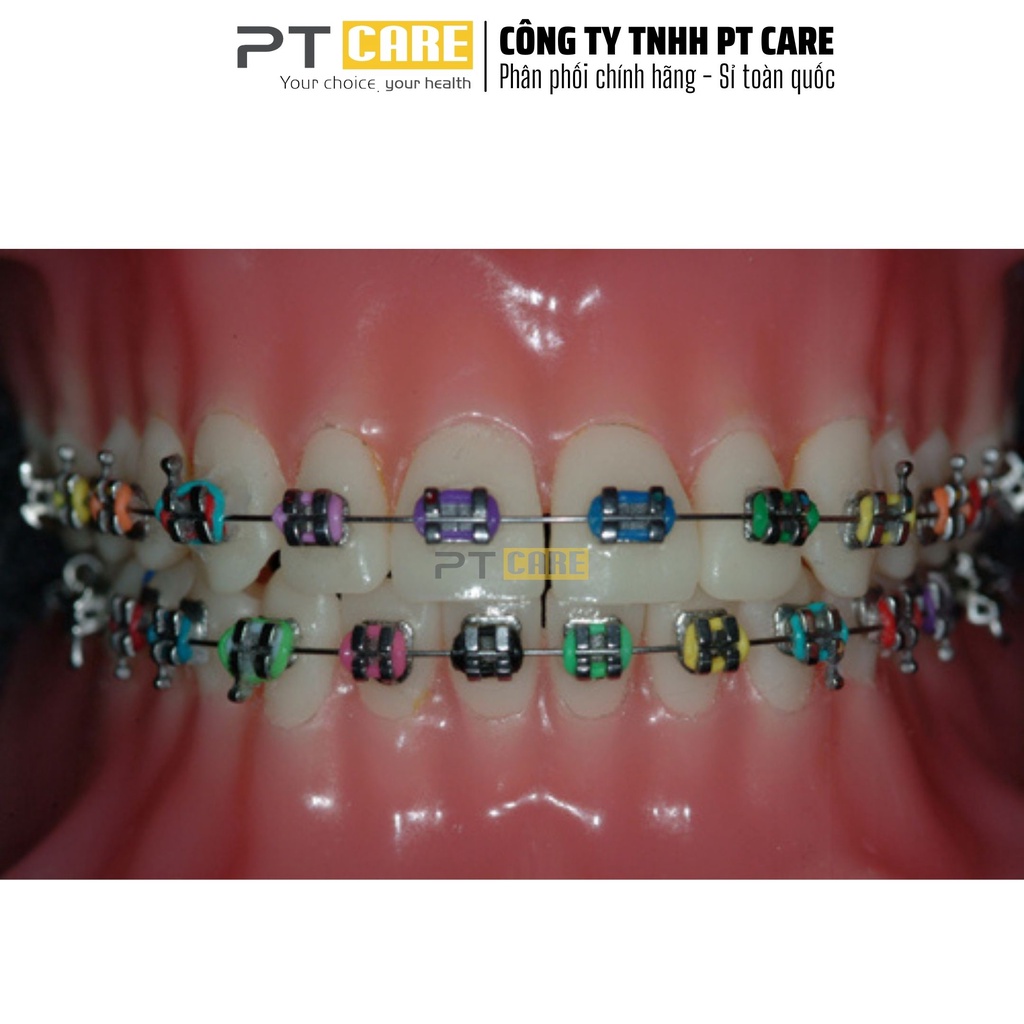 PT CARE |[ĐƯỢC CHỌN MÀU] 01 Thanh Chun Màu Mắc Cài Thun Đơn, Tại Chỗ, Niềng Răng, Chỉnh Nha