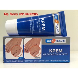 Kem giảm đồi mồi tay Kpem Nga