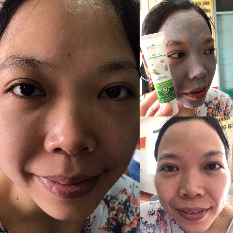 Detox Whitening Mask Thải Độc Da