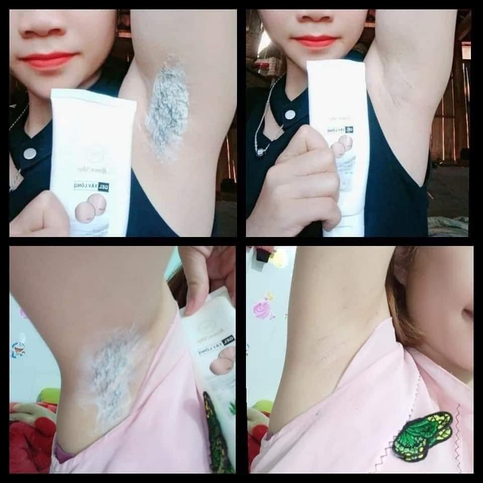 Combo Kem tẩy lông + Cao triệt lông vĩnh viễn vùng kín bikini nách  Mamen Shop - 120ml. An toàn cho mọi loại da nhạy cảm