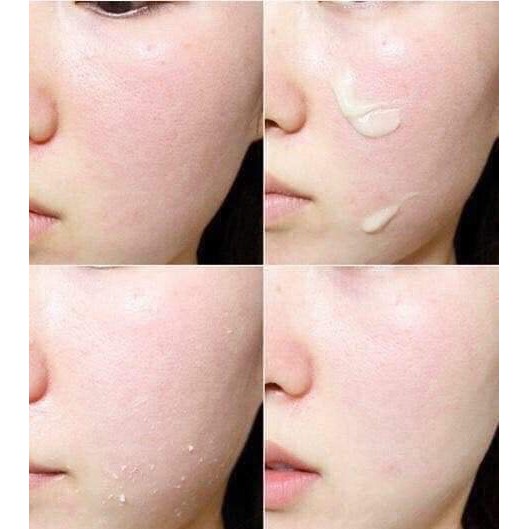 Combo 10 Gói Tẩy Da Chết Whoo Dưỡng Trắng Mịn Giảm Mụn Đầu Đen 1ml | BigBuy360 - bigbuy360.vn