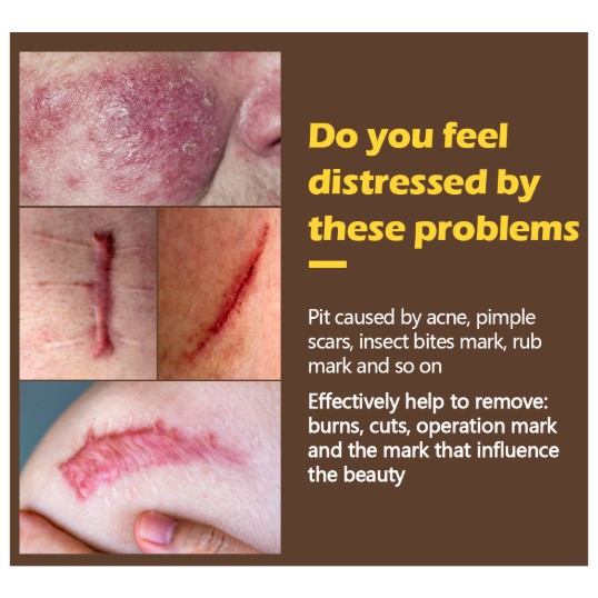 Kem Làm Mờ Sẹo Vibrant Glamour Treatment Gel VG