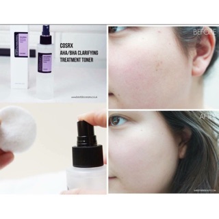 💧Siêu phẩm Cosrx AHA BHA Clarifying Treatment Toner💧