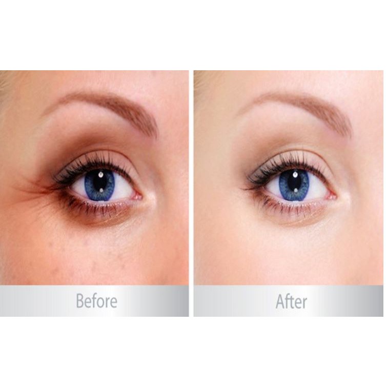 Kem Dưỡng Mắt Balance Active Formula Eye Cream | BigBuy360 - bigbuy360.vn