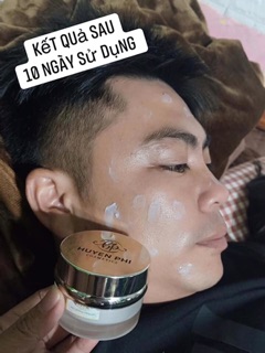 KEM NÁM HUYỀN PHI