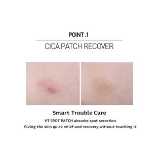 [VT] Spot Patch 12 / 48 Miếng dán / Miếng dán mụn / Miếng dán mụn trứng cá _ Jul