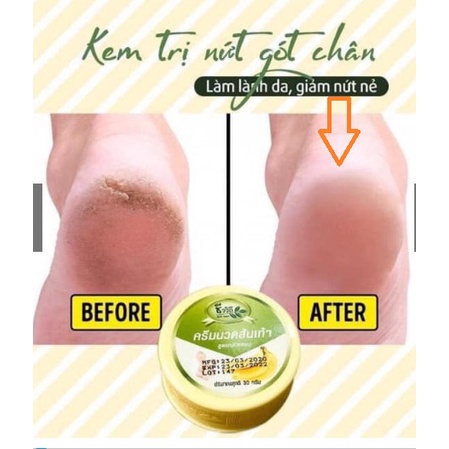Kem Nứt Gót Chân BANANA (chuối)