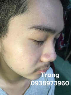 Combo Thuốc Bắc Tái Tạo Da Dưỡng Da