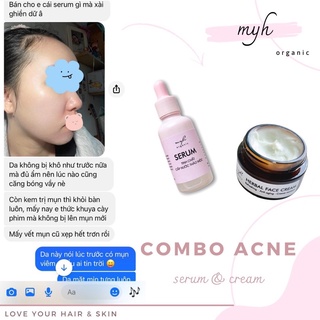 Kem Dưỡng Dành Cho Da Mụn
