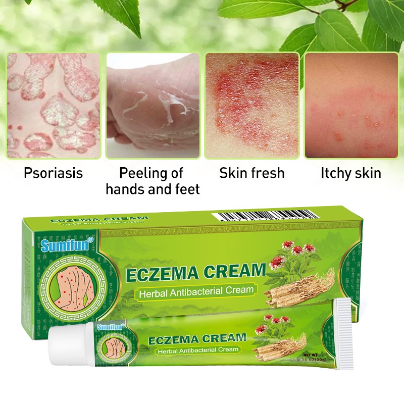 Kem hỗ trợ bôi chàm ngứa ECZEMA, tinh chất thảo dược thiên nhiên