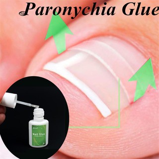 ]BK Paronychia Nail Glue Ingrown Toenail Correction Pedicure Toe Patch Foot Ca thumbnail