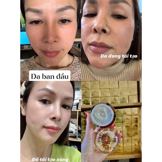Kem tái tạo Chamomileskill -  Hộp 30Gram Mẫu Mới 2025